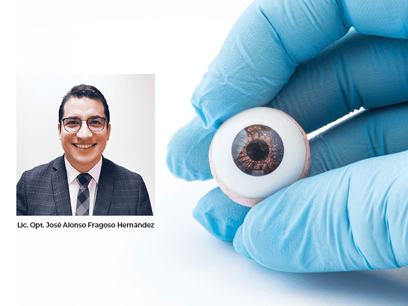 Extrusión de implantes porosos y prótesis ocular