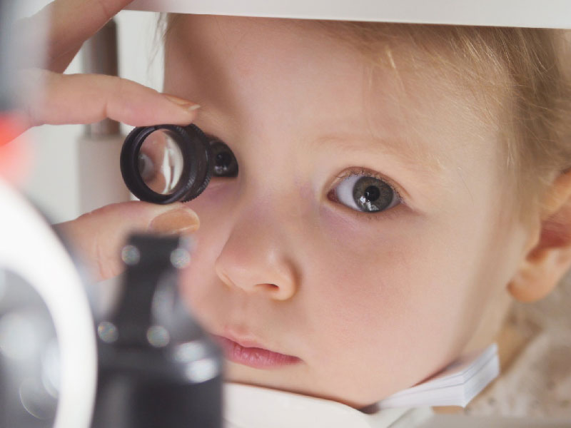 Salud ocular infantil con uso diario de lentes de contacto desechables