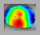 Se ha sugerido que la topografía es el estándar de oro para la adaptación de ortoqueratología porque el mapeo detallado de la córnea permite una adaptación más precisa y una lente hecha a la medida.