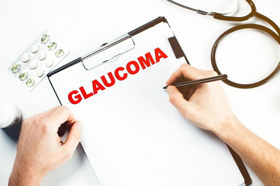 El glaucoma es una enfermedad neurodegenerativa caracterizada por el daño progresivo del nervio óptico, que puede estar asociado a un aumento de la presión intraocular (PIO).