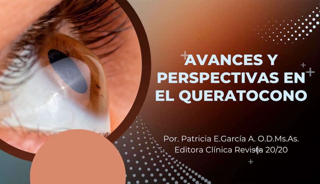 Avances y perspectivas en el queratocono Avances y perspectivas en el queratocono