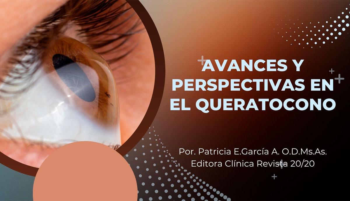 Avances y perspectivas en el queratocono