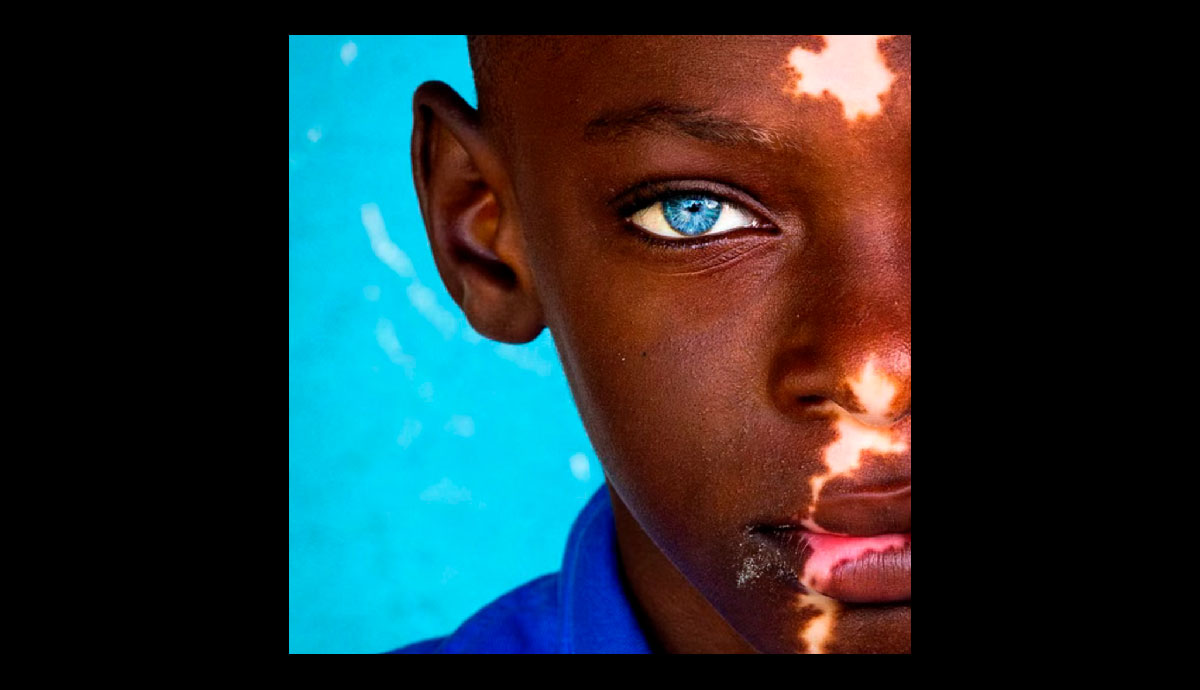 La IAPB anunció los ganadores de su 10° concurso de fotografía del Día Mundial de la Visión