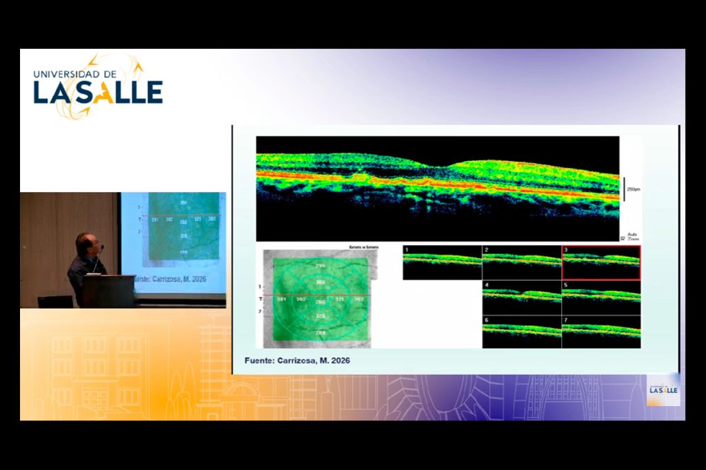 Un espacio para la prevención: Bogotá fue escenario del panel “Visión 360°” en los 60 años del programa de Optometría