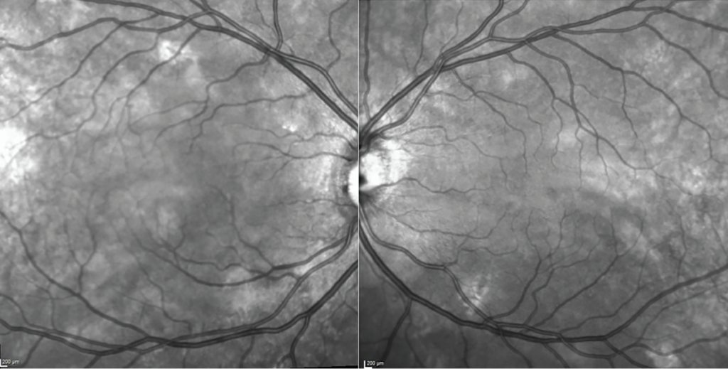 El bello arte de la fotografía de retina