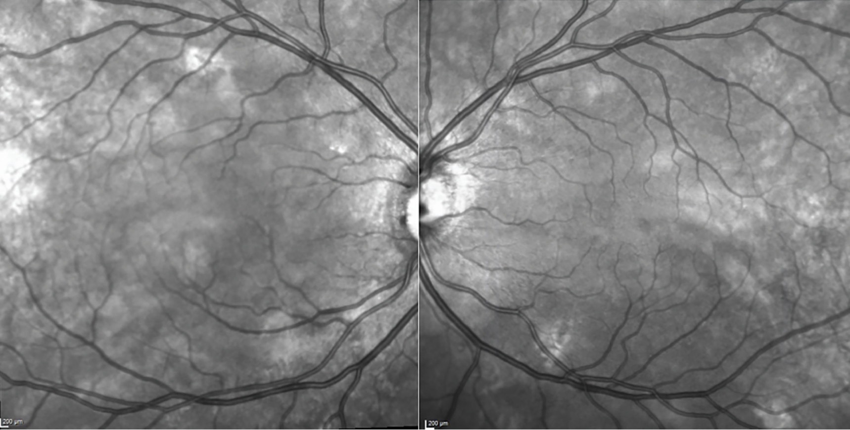 El bello arte de la fotografía de retina