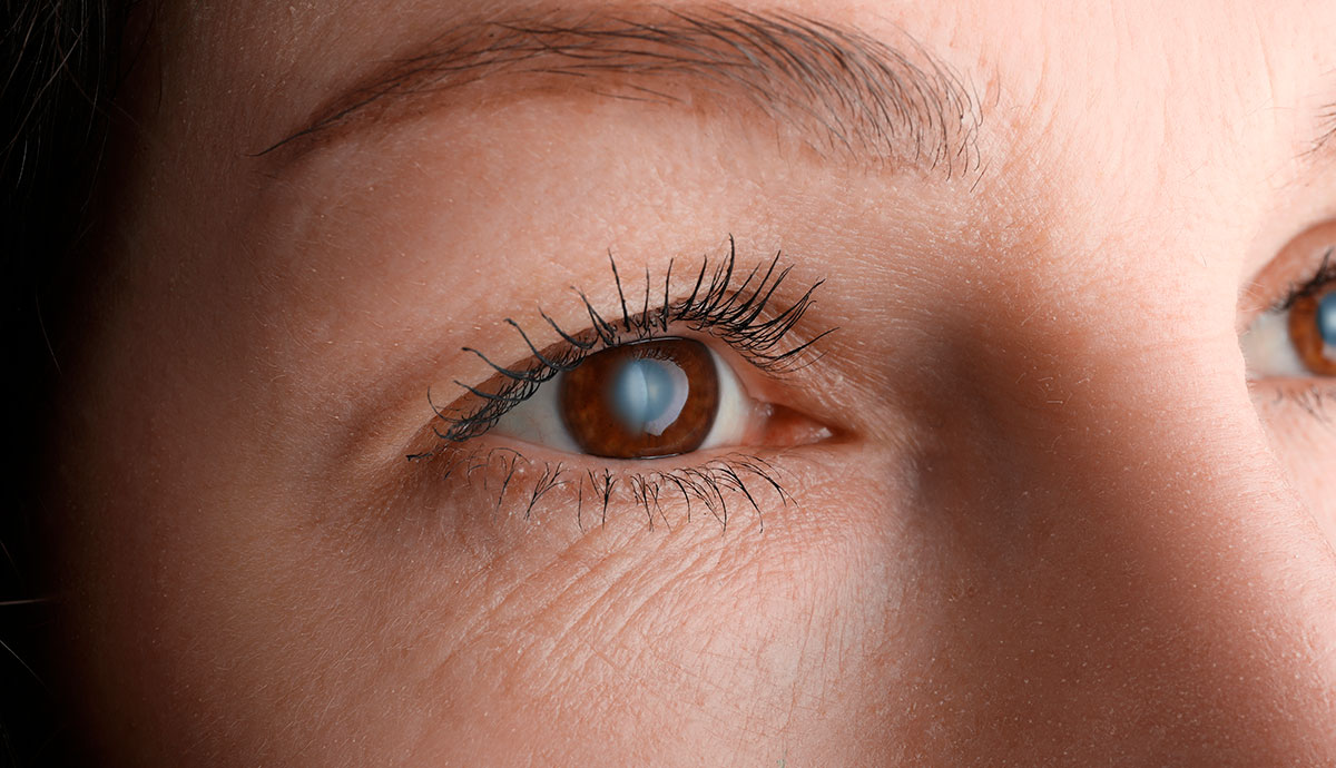 Exposición a la radiación ultravioleta y salud ocular