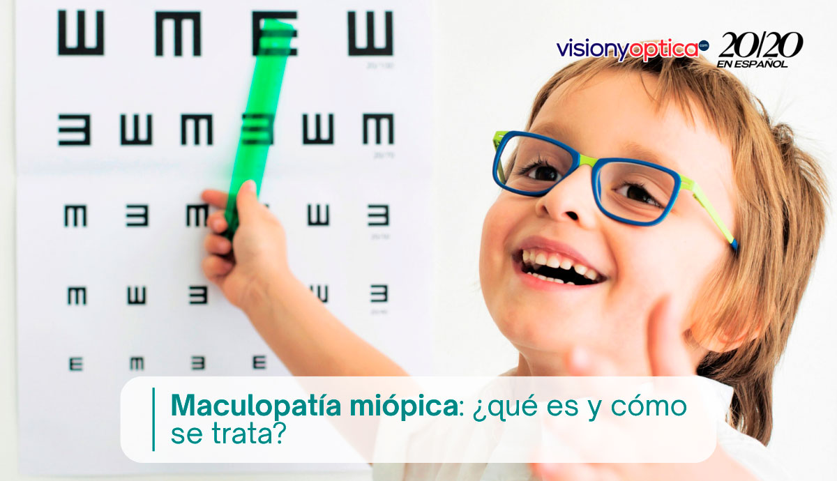 Maculopatía miópica: ¿qué es y cómo se trata?