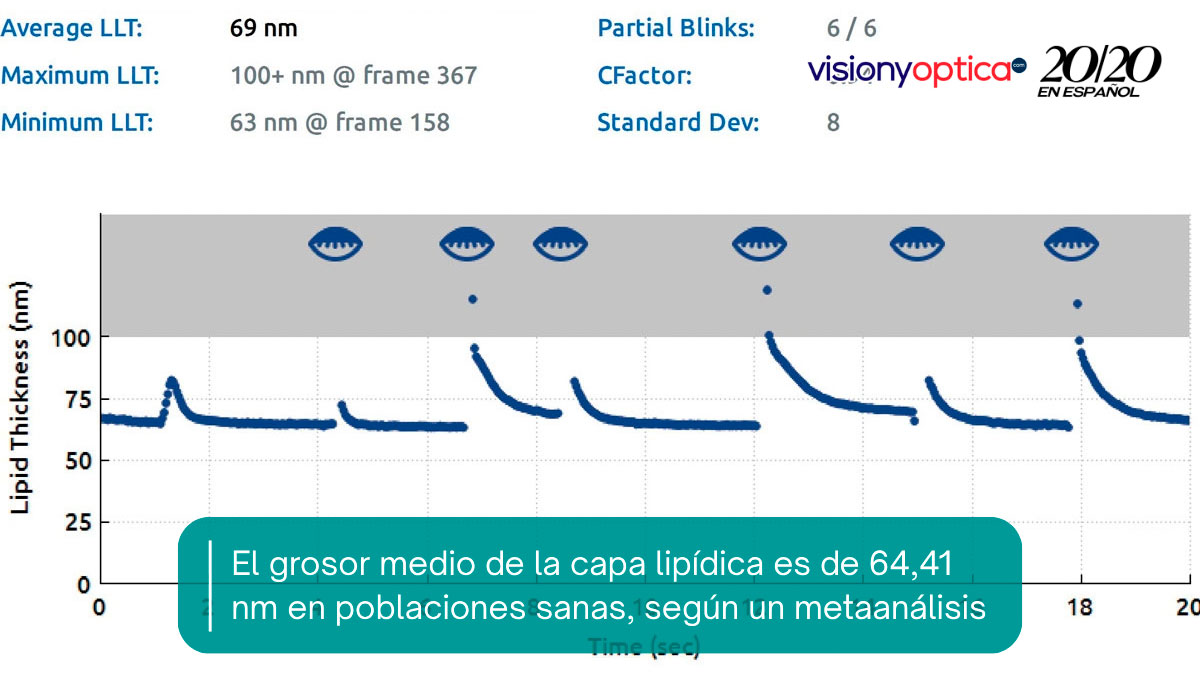 El grosor medio de la capa lipídica es de 64,41 nm en poblaciones sanas, según un metaanálisis